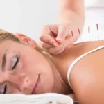 Dry Needling Physiotherapy In Thane