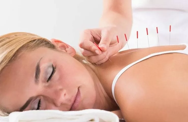 Dry Needling Physiotherapy In Thane